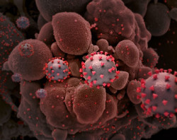 Detectan ARN del SARS-CoV-2 en heces, plasma y orina en pacientes con s&iacute;ntomas persistentes tras la COVID-19