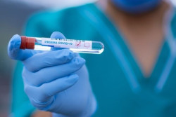 Espa&ntilde;a suma 10.721 casos y 95 muertes con COVID-19, mientras la incidencia sube 8 puntos en mayores de 60 a&ntilde;os