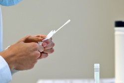  Espa&ntilde;a suma 14.373 casos y 245 muertes con COVID-19, mientras la incidencia en mayores baja 60 puntos