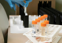 Espa&ntilde;a supera los 6.600 casos de viruela del mono, 31 de ellos en Cantabria, seg&uacute;n Sanidad