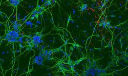 Investigadores del CSIC crean un hidrogel que permite cultivar células neurales para reparar lesiones medulares
