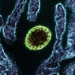 Sanidad afirma que la probabilidad de detectar un caso aut&oacute;ctono del virus Nipah en Espa&ntilde;a "es remota"