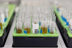 Sanidad confirma 156 casos positivos de viruela del mono en Espa&ntilde;a