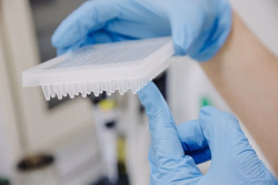 Un 40% de pacientes con viruela del mono requiere tratamiento m&eacute;dico seg&uacute;n un estudio
