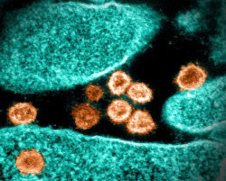 Un estudio apunta que las variantes de la COVID-19 se gestan en pacientes cr&oacute;nicos con inmunosupresi&oacute;n