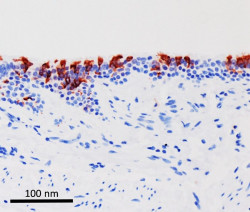 Un estudio apunta que &oacute;micron infecta "m&aacute;s r&aacute;pido y mejor" que Delta pero con menor gravedad en el pulm&oacute;n