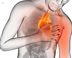 Actuar a tiempo en un infarto es "clave" para disminuir el da&ntilde;o en el tejido card&iacute;aco