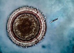 Algunos espermatozoides `envenenan` con un factor gen&eacute;tico a sus competidores, para superarlos