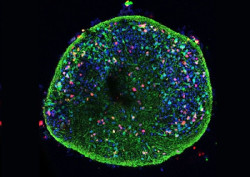 Alteraciones celulares del Alzheimer, observadas tambi&eacute;n en cultivos de neuronas infectadas por virus del herpes labial