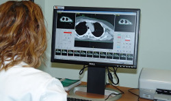 Aplican la IA para predecir posibles recaídas en pacientes con cáncer