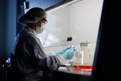 Bayer espera que sus terapias avanzadas para frenar el Parkinson lleguen a los pacientes para 2030