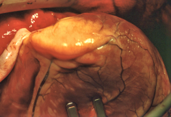 Cantabria ante su peor enemigo.Dr. José Manuel Revuelta  Catedrático de Cirugía. Profesor Emérito de la Universidad de Cantabria