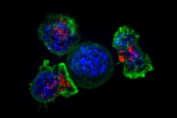 Consiguen evitar que las c&eacute;lulas T que combaten el c&aacute;ncer se quemen antes de terminar el trabajo