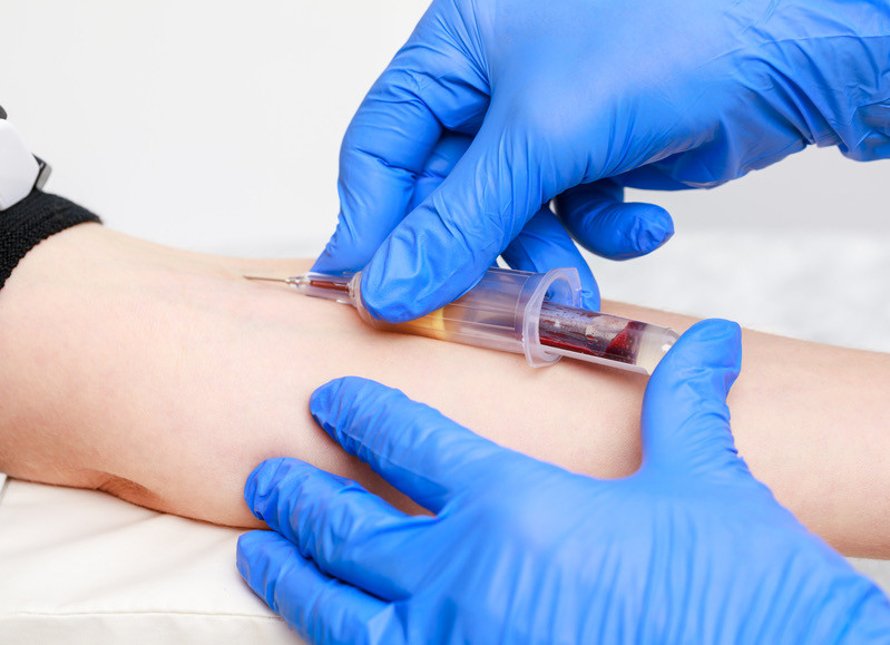 Desarrollan un an&aacute;lisis de sangre que podr&iacute;a detectar la recurrencia del c&aacute;ncer de mama