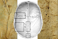 Describen una red de microcanales en el cráneo que podría ser clave en las enfermedades neurológicas