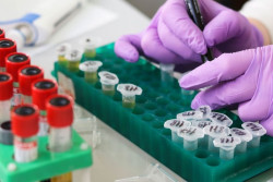 Descubren biomarcadores sanguíneos que anticipan la diabetes tipo 2 hasta siete años antes del diagnóstico