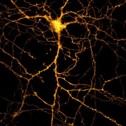 Descubren cómo dos formas de la misma familia de proteínas afectan al aprendizaje y la memoria de manera opuesta