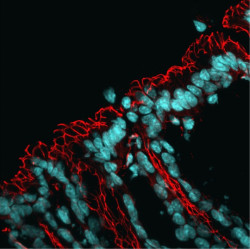 Descubren un mecanismo celular que altera la microbiota intestinal y aumenta la aparición de enfermedades múltiples