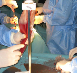 Descubren un nuevo enfoque en el uso de c&eacute;lulas madre para mejorar el trasplante de m&eacute;dula &oacute;sea