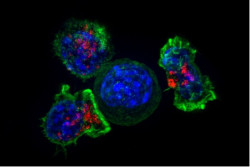 Diseñan células genéticamente y ocultas en biocápsulas para atacar tumores sólidos desde dentro