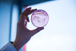 `E. coli` es la bacteria resistente a los antibi&oacute;ticos m&aacute;s com&uacute;n en la Uni&oacute;n Europea