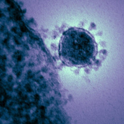 EEUU eleva a 17 los muertos por coronavirus y supera los 300 contagiados