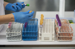 El Banco de Sangre de Cantabria llama a la población a donar plasma para avanzar en autosuficiencia