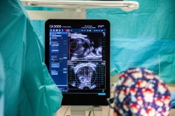 El cáncer de próstata "sigue siendo un tema tabú", pese a los 35.000 casos anuales en España, advierte un experto