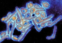  El director general de Salud P&uacute;blica de Cantabria, Reinhard Wallmann dice que se est&aacute; actuando seg&uacute;n el protocolo ante el caso sospechoso de virus de Marburg