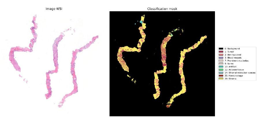 El IFCA, Valdecilla y Siali, premiados por un proyecto para mejorar el diagn&oacute;stico de c&aacute;ncer de pr&oacute;stata con IA