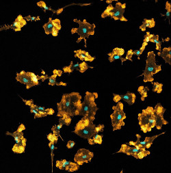 El sistema inmunitario puede extraer nutrientes de los patógenos que ingiere