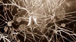 Exámenes oculares pueden detectar signos de Alzheimer y otras demencias antes de que aparezcan los síntomas