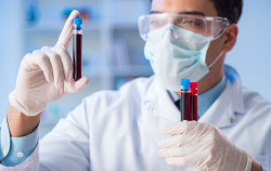 Hematólogo destaca que los avances en medicina personalizada suponen una "nueva etapa" contra la leucemia mieloide aguda