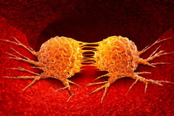 Identifican más de un centenar de genes implicados en la metástasis de múltiples cánceres