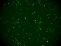 Identifican un mecanismo en gusanos que les ayuda a defenderse frente a reinfecciones de virus
