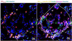 Investigadores de la diabetes detectan c&eacute;lulas T peligrosas en el p&aacute;ncreas, incluso en personas sanas