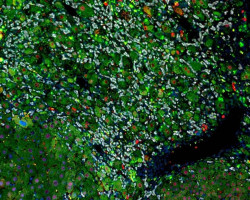 Investigadores del CNIO identifican un mecanismo causal de la cirrosis hep&aacute;tica