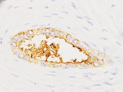 Investigadores espa&ntilde;oles crean un prototipo de test para detectar c&aacute;ncer de p&aacute;ncreas "en minutos" con muestras de sangre