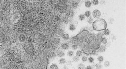 Investigadores españoles desarrollan una vacuna intranasal que elimina el virus del Covid-19 en ratones