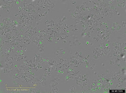 Investigadores españoles identifican un mecanismo bacteriano capaz de destruir células tumorales