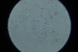 Investigadores logran anular una proteína presente en las células para mejorar la quimioterapia en cáncer de páncreas