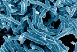 La ciudad de origen entre la cepa de tuberculosis y el humano puede ampliar el riesgo de infección, según estudio