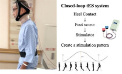 La estimulaci&oacute;n cerebral puede ayudar a caminar mejor a los pacientes con Parkinson, seg&uacute;n un estudio
