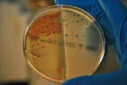 Las bacterias resistentes a los antibióticos ya provocan más muertes que el sida y la malaria, según un estudio