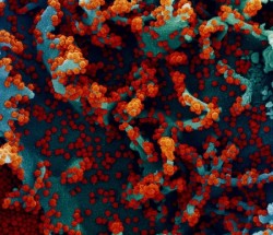 Las células T de los resfriados comunes protegen contra la infección por SARS-CoV-2, según estudio