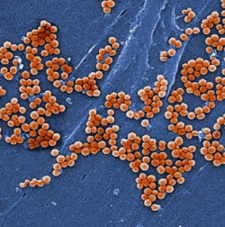 Las mutaciones gen&eacute;ticas ayudan al MRSA a volverse altamente resistente a los antibi&oacute;ticos