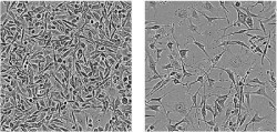 Las prote&iacute;nas de uni&oacute;n al ARN, posible objetivo farmacol&oacute;gico para el c&aacute;ncer de mama de dif&iacute;cil tratamiento
