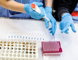 Los investigadores encuentran objetivos terap&eacute;uticos para combatir el SARS-CoV-2