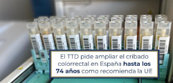 Los oncólogos piden ampliar los cribados de cáncer de colon en España hasta los 74 años
