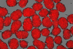 Nueva esperanza para el enfoque de células madre como tratamiento de la diabetes